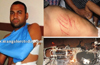 Bhatkal : Gang brutally assaults duo; makes vain bid to set them afire